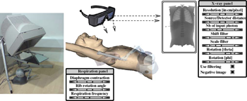 Villard2009IntJComputAssistRadiolSurg illustration